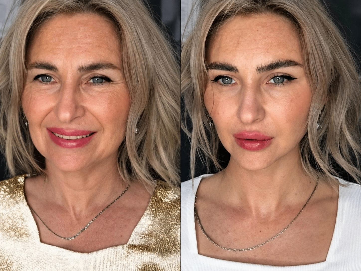 Avant/après — Full Face & Contouring Facial (photo 1)