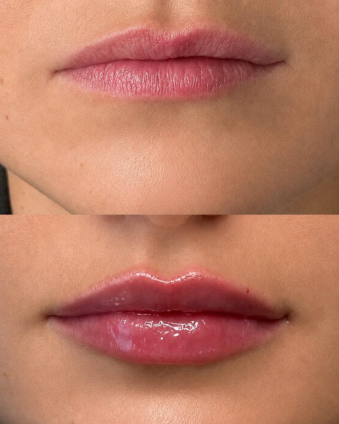 Avant/après — Lèvres – Russian Lips (photo 3)